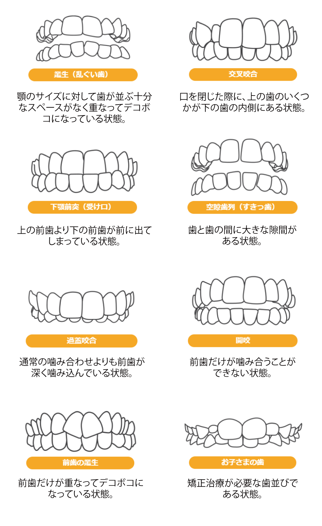 当該インビザライン矯正各種の治療対象